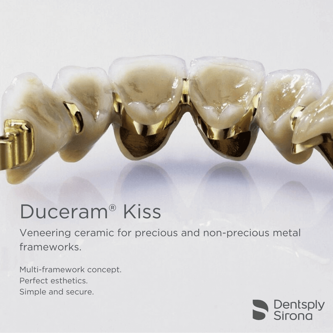 ceramica Duceram kiss prezentare