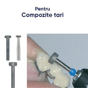 freze diamantate tip roata, exemplu de lucrare. Freze dentare pentru compozite tari